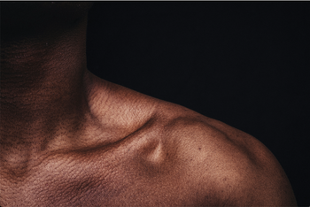 BFR for Rotator Cuff: Rehabilitation Guide